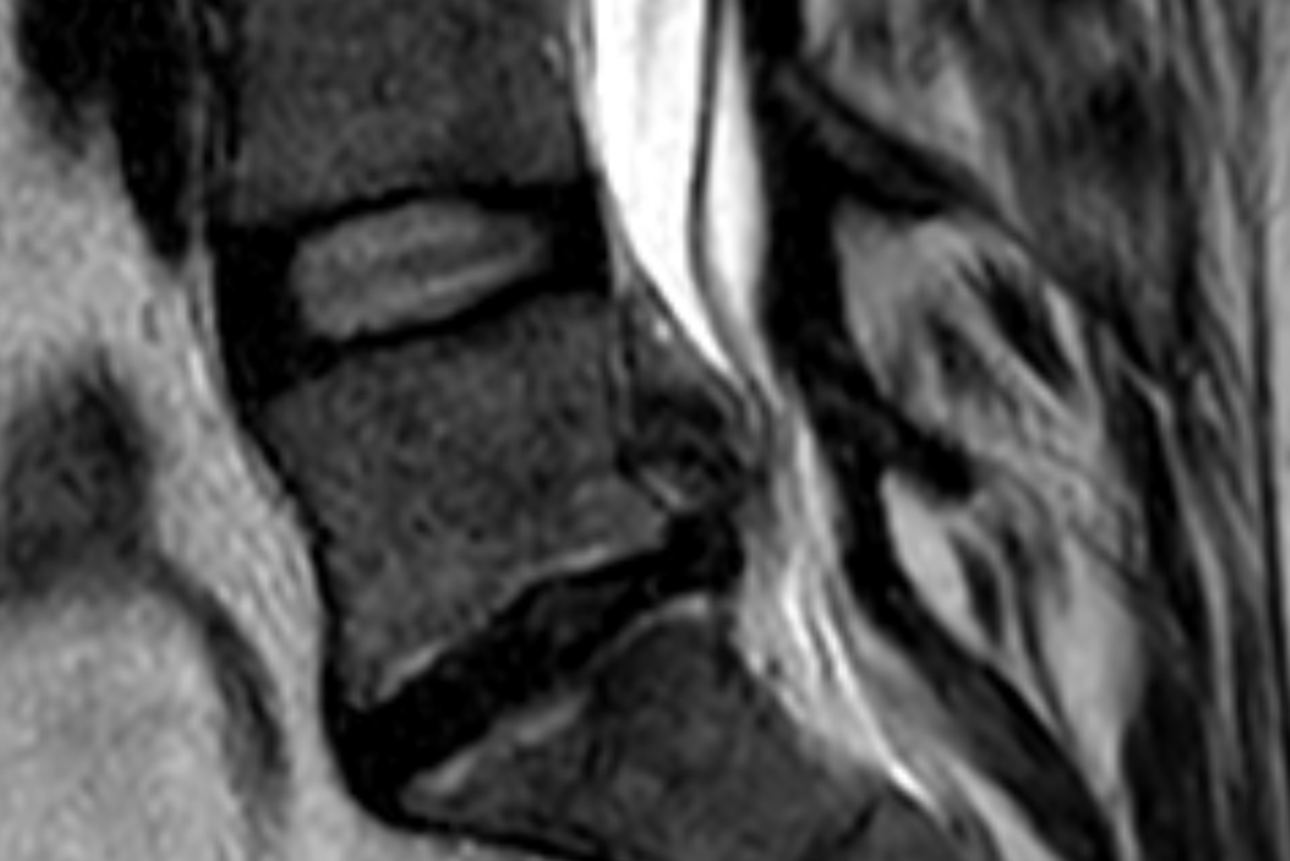 Wirbelsäule DietrichBonhoefferKlinikum