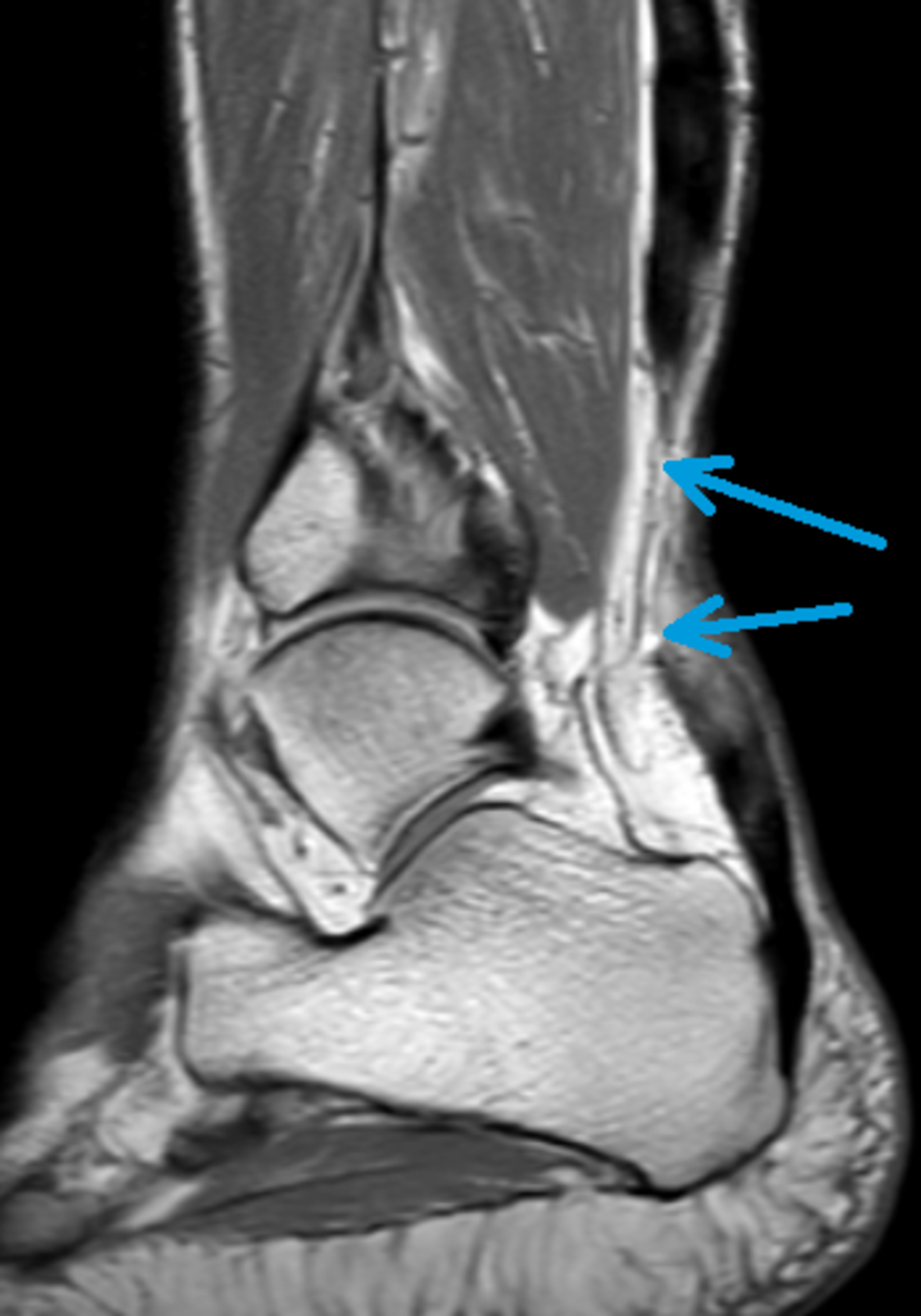 Fuß- und Sprunggelenk – Dietrich-Bonhoeffer-Klinikum